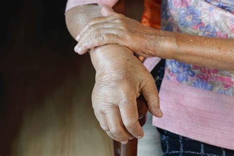 Mão Inchada O Que Pode Ser - Você está com as mãos inchadas? Fique atento!