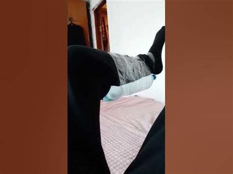 контрактура коленного сустава.. - YouTube