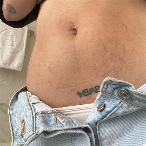 Halsey Shows Postpartum Body After ‘SNL’ Performance: Photos | Us Weekly