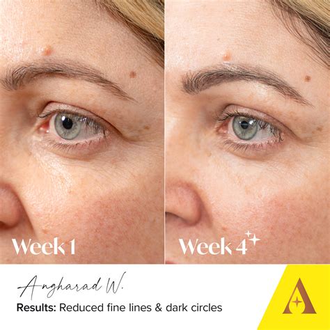 Deep Lift Collagen Boosting Eye Cream, 15ml – Absolute Collagen