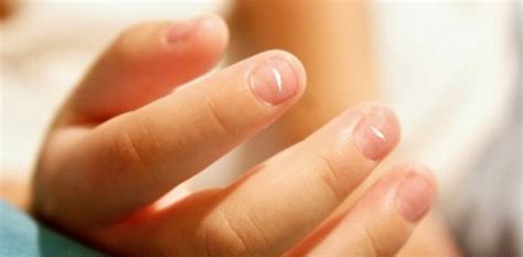 LEUCONIQUIA: MANCHAS BLANCAS EN LAS UÑAS - dePiesyManos Academy