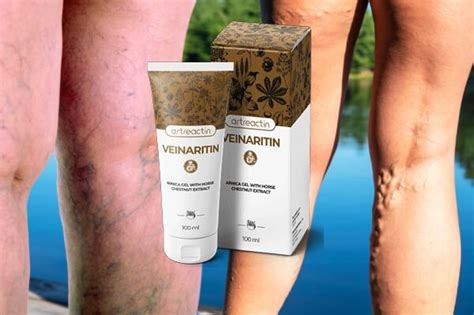 Veinaritin - естествен гел за варикоза? Мнения, цена?