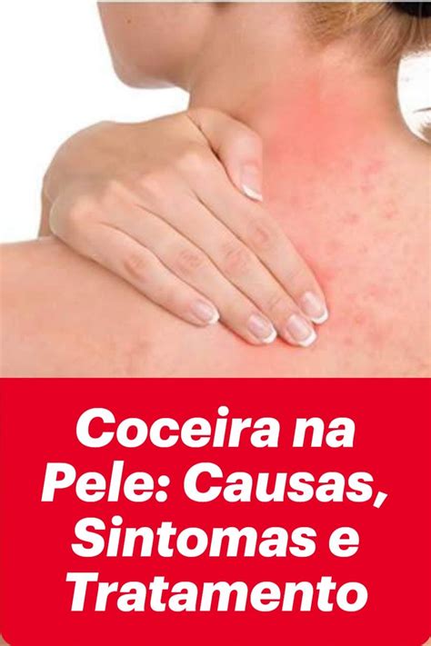 Coceira No Corpo Antes De Dormir - Coceira Na Pele: Causas, Sintomas E Tratamento | Coceira na pele ...