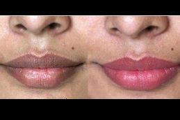 What Can Help Smokers Lips | Lipstutorial.org