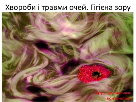 Хвороби і травми очей. Гігієна зору - презентация онлайн