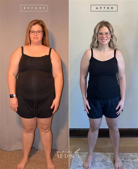 Medical Weight Loss with Semaglutide & Tirzepatide | Main Street Med S