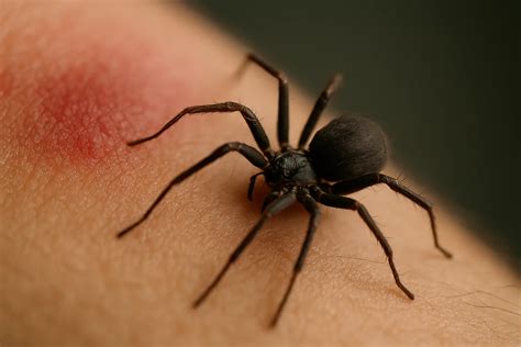 Imagens De Picada De Aranha - 6