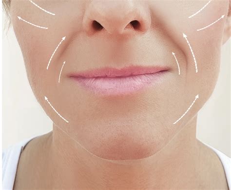 BIOFILLER – innosoulmed.com