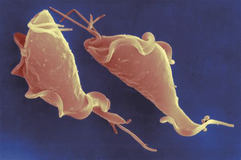Trichomonas Vaginalis Under Microscope