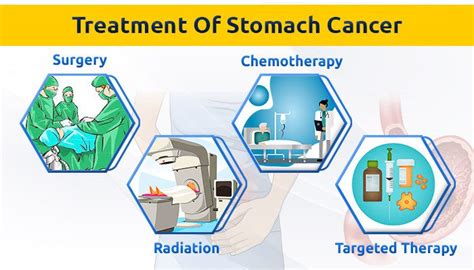 Stomach cancer - Best oncologist in Delhi - Oncoplus Hospital