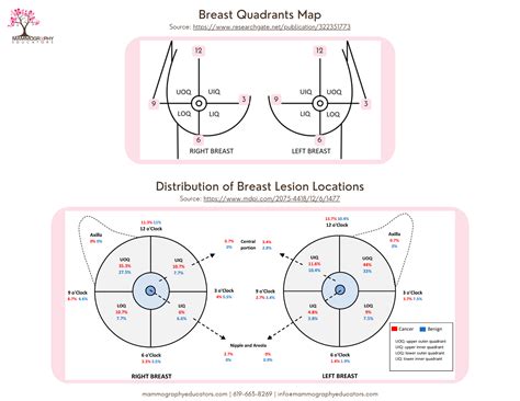 Breast Imaging Clock Face at Carrie Hernandez blog