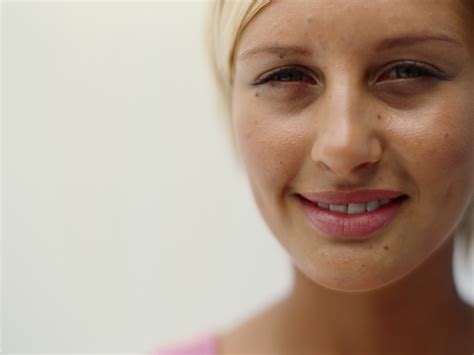 face with moles 4