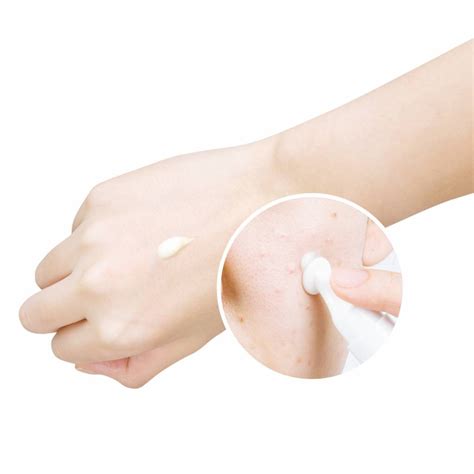 YADAH - Anti-T Red Zero Spot Cream - 15 g - Korean skincare & cosmetics ...