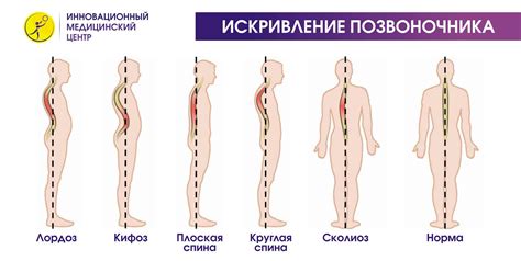 Боль в левом боку на уровне талии со спины: тянущая, сильная, ноющая ...