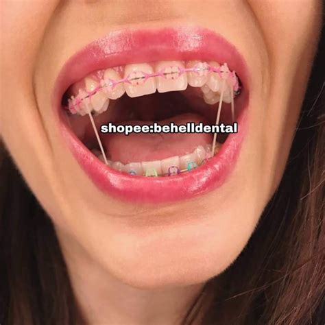 detail contoh behel keramik koleksi nomer