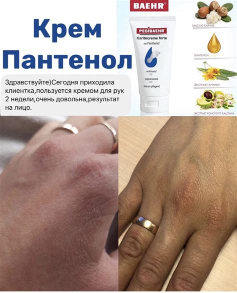 ᐉ Крем с пантенолом для ног 500мл (KARITECREME FORTE) , PEDIBAEHR ...