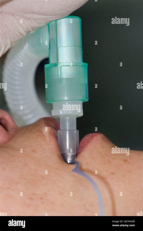 intubated patient patient    intubated prior  surgery