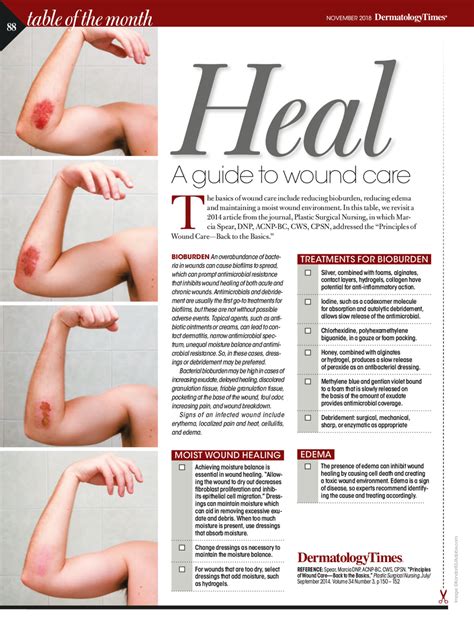 A guide to wound care