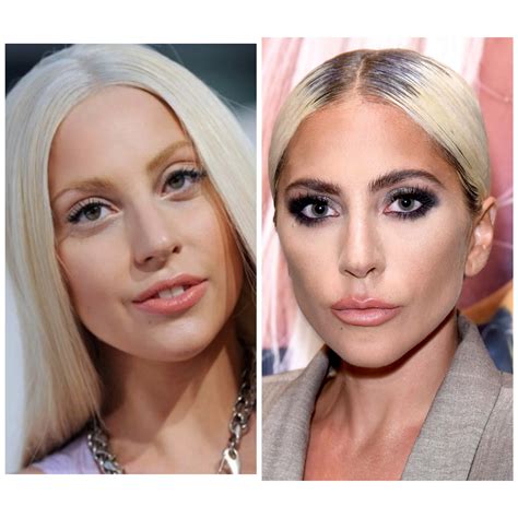 Lady Gaga's Transformation: Experts Reveal The Untold Story Behind The Icon Image 2