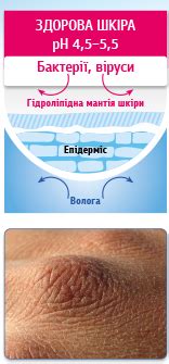 Клобаза. відновлює епідермальний бар'єр