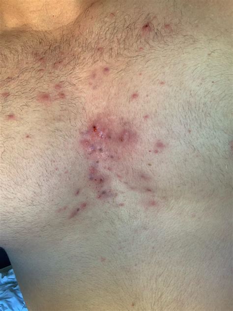 Testosterone from 242 to 273 free testosterone direct 10 to 15 in about