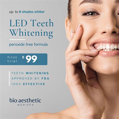 teeth whitening   lily selwyn blog