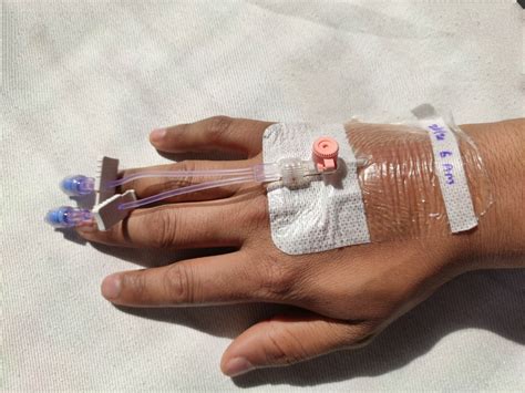Are Therapy Leaks A Sign Of A Bigger Problem? Doctors Sound The Alarm!