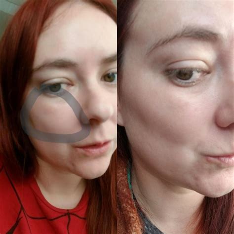 festoons on face 8