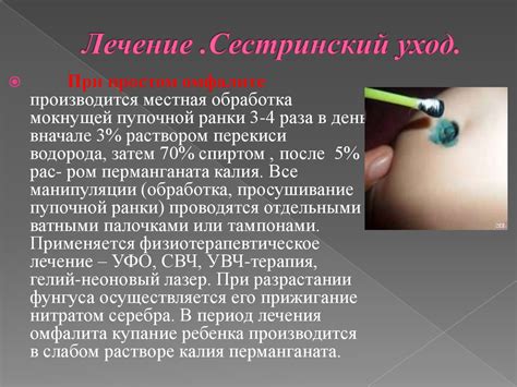 Омфалит новорожденных - презентация онлайн