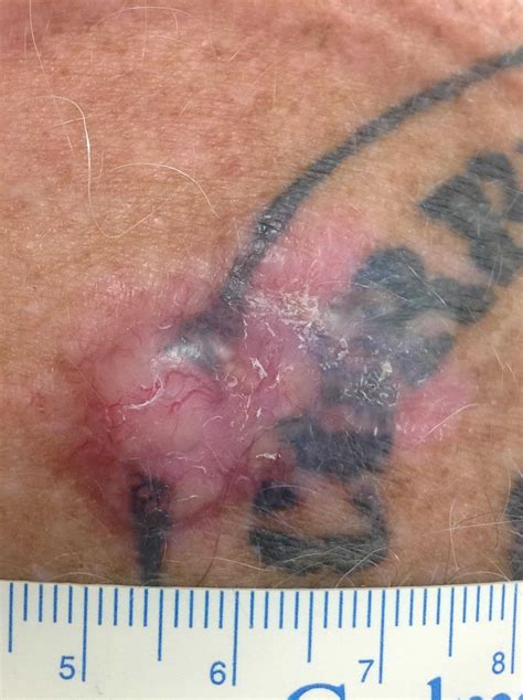 Byford Skin Cancer Clinic | Byford Skin Cancer Clinic