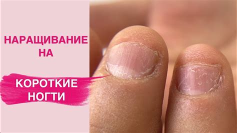 Наращивание ногтей на КОРОТКИХ НОГТЯХ - YouTube