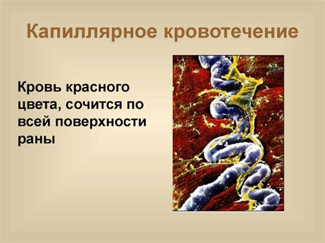 Правила оказание первой медицинской помощи. Кровотечения - презентация ...