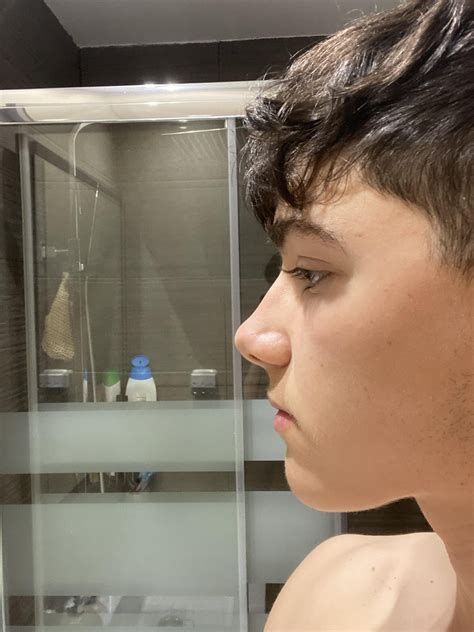 Mewing progress pictures (Aug 2021 - May 2022 - Dec 2022) : r/Mewing