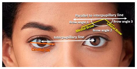 Celebrities With Negative Canthal Tilt
