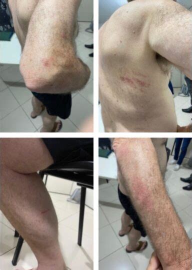 Lesão Corporal Contra Idoso - Mulher é Presa Acusada De Lesão Corporal E Cárcere Privado Contra Idoso ...