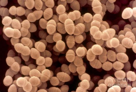 Enterococcus Faecium, Sem Photograph by Scimat - Pixels