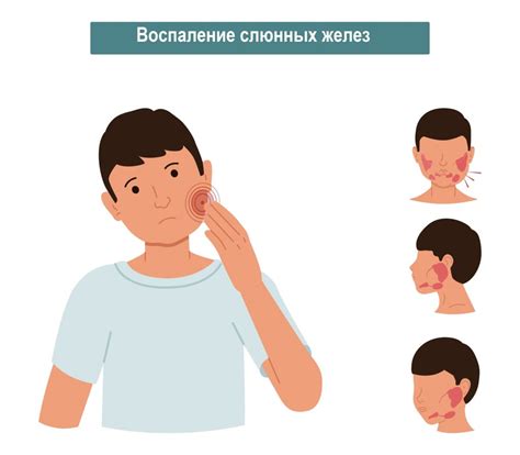 Эпидемический паротит (свинка): что это такое и как с этим бороться