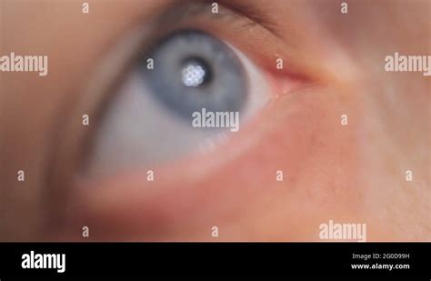 Woman dripping eye eyes drops Stock Videos & Footage - HD and 4K Video ...