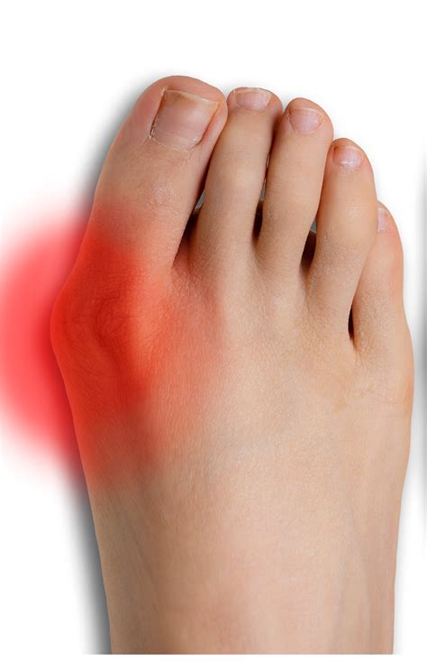 pain  foot  big toe joint  carlos malbrough blog