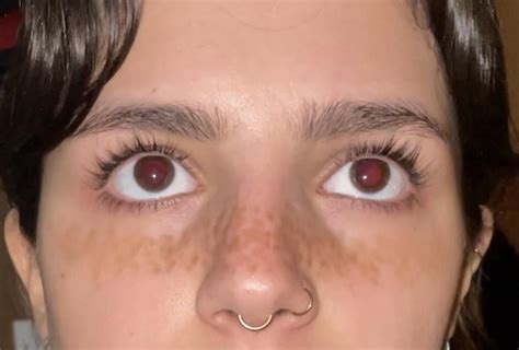 My pupils dilate when I go back on my meds for some reason (40mg fluoxetine) : r/DilatedPupils