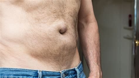 Hernien: Ursachen, Behandlung, Vorbeugung | gesund.bund.de