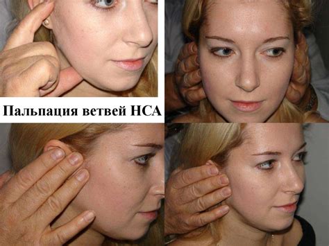 Транзиторная ишемическая атака. Этиология. Патогенез. Клиника ...