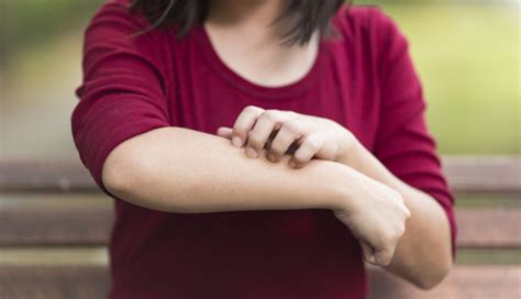 Orticaria nei bambini: come riconoscerla e curarla - Uppa