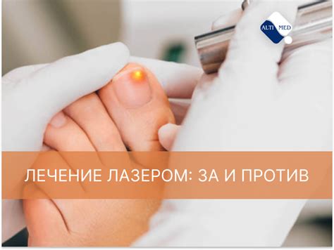 Лечение ногтевого грибка при помощи лазера или Брт. Что эффективнее?
