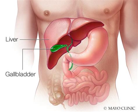 Liver hemangioma - Symptoms & causes - Mayo Clinic