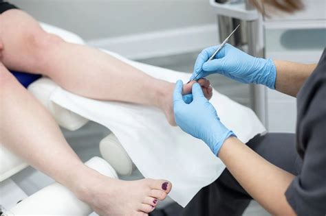 ᐈ Видалення нігтьової пластини у Львові - Центр IDERMIC