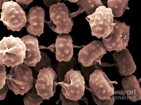 Aspergillus Acidus Sporesi, Sem Photograph by Scimat - Pixels