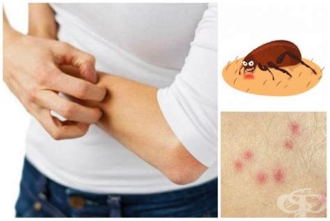 Предпазване от ухапване от бълхи | Лечение | Print tattoos, Paw print ...