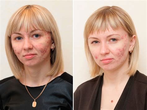 Очищающие средства для лица: отзывы | Beauty Insider