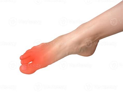 Foot pain with inflamed joint and neuropathy. Big toe ache, cramp, or